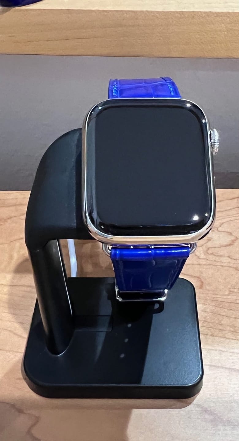 Customer photo review of Apple Watch Charger | All iWatch Series (Black)