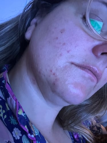 Customer photo review of 20-Day Inside & Out™ Gut Program