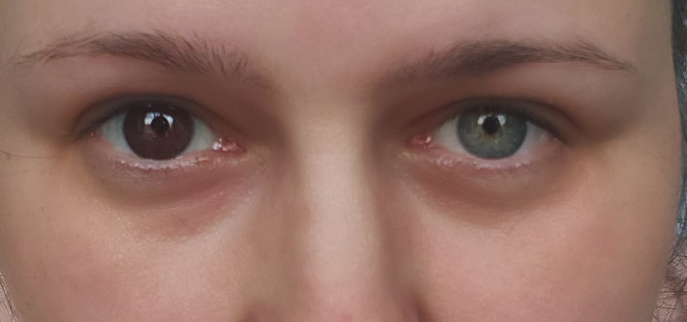 Customer photo review of Eyeling Dark Brown