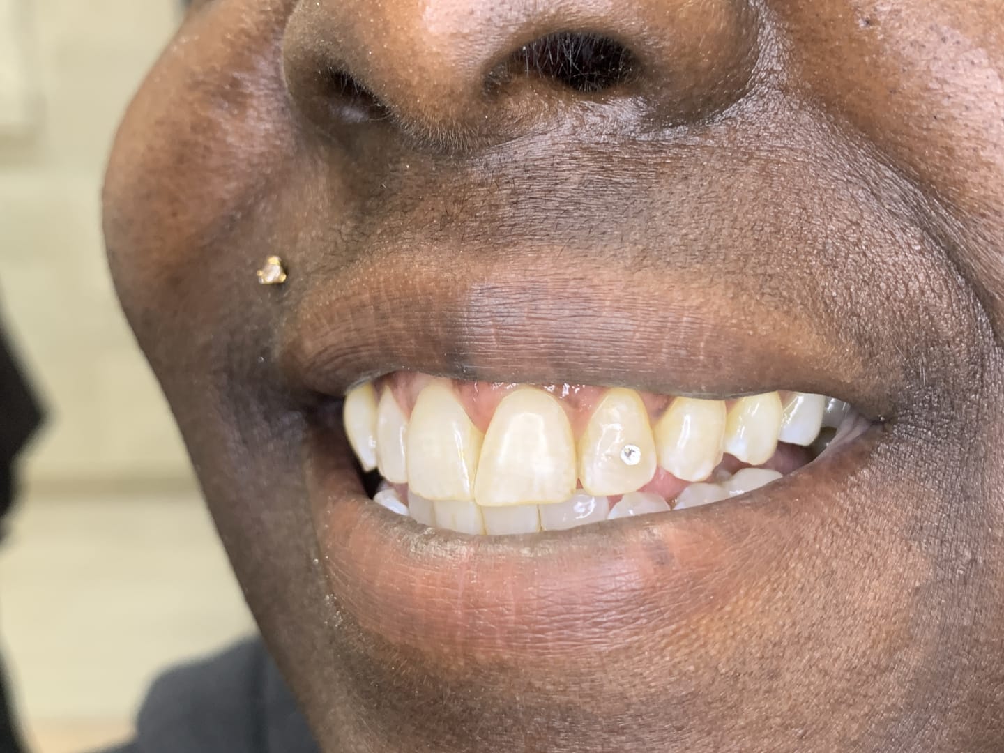 Customer photo review of Crystal Clear 1.8mm - 6-pack