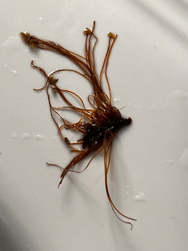 Customer photo review of Paragon | Parasite Cleanse