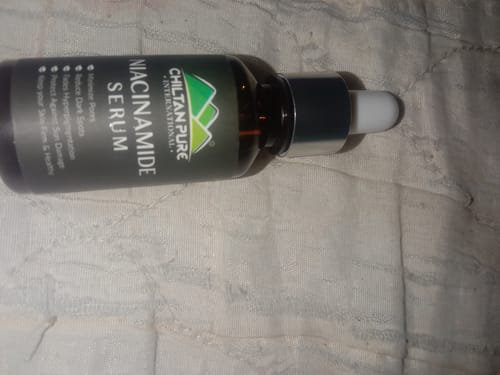 Customer photo review of Niacinamide Serum - Strengthens Skin's Barrier & Boosts Skin's Immunity