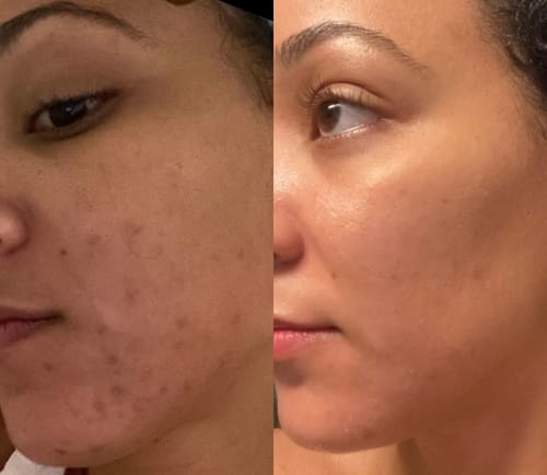 Customer photo review of Tisane Glow up ®