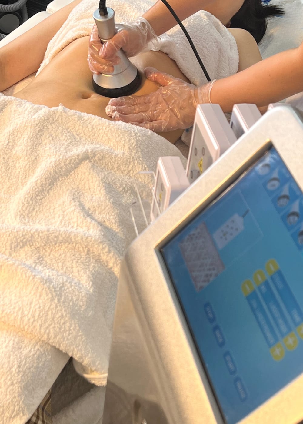 Customer photo review of Eris Lipo Cavitation Machine 6 in 1 Professional