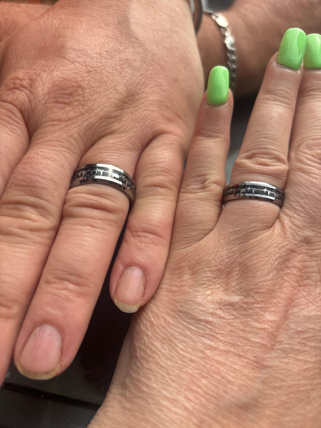 Customer photo review of The Loving Heartbeat Wonder Ring Set