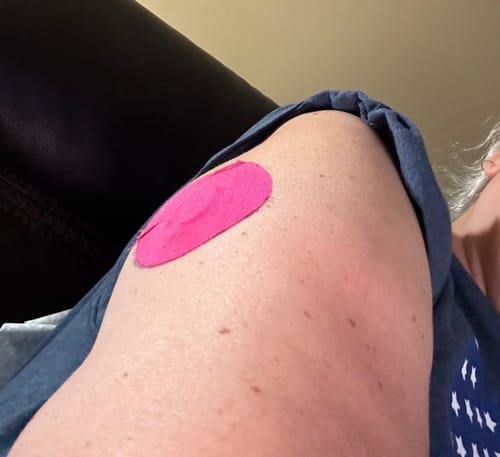 Customer photo review of Skin Grip Original - Dexcom G7 Adhesive Patches - 20 Pack