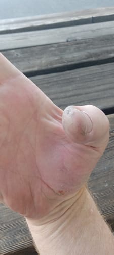 Customer photo review of Palm Polish All Natural Hand Salve (50 Grams)