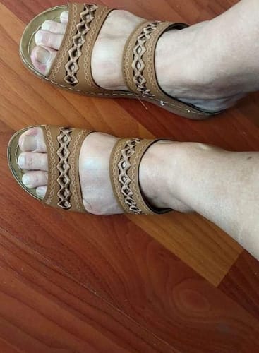 Customer photo review of ALYSSON'S™ WOMEN'S THICK ORTHOPEDIC SANDALS