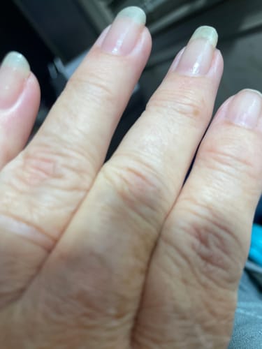Customer photo review of Rocket Nail Fuel Nail Repair - Clear