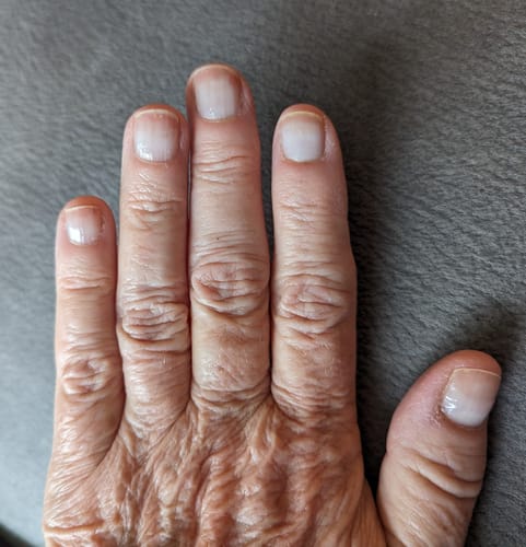 Customer photo review of Rocket Nail Fuel Nail Repair - Purple