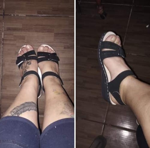 Customer photo review of WOMEN'S COMFORTABLE ORTHOPEDIC SANDALS 2024