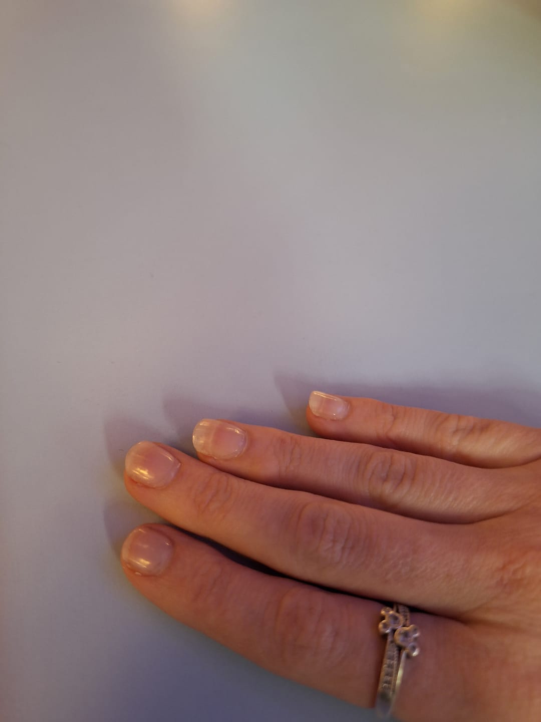 Customer photo review of Crystal Clear DIY Semicured Gel Nail Sticker Kit (STOP NAIL BITING & GROW BRITTLE NAILS)