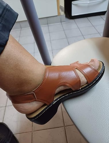 Customer photo review of PREMIUM™ ORTHOPEDIC LEATHER WEDGE SANDALS 2024