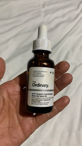 Customer photo review of 100% Organic Cold-Pressed Rose Hip Seed Oil 30ml