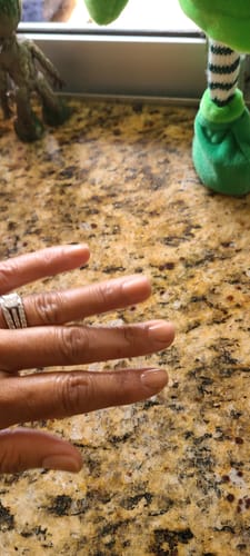 Customer photo review of Rocket Nail Fuel Nail Repair - Purple