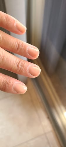 Customer photo review of Vanish Cuticle Remover