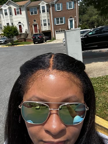 Customer photo review of The complete all in one wig install kit