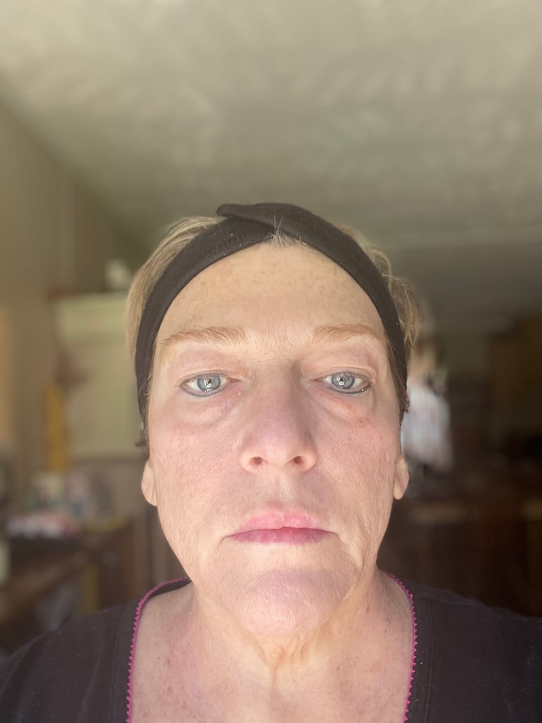 Customer photo review of Deep Clean Cleanser