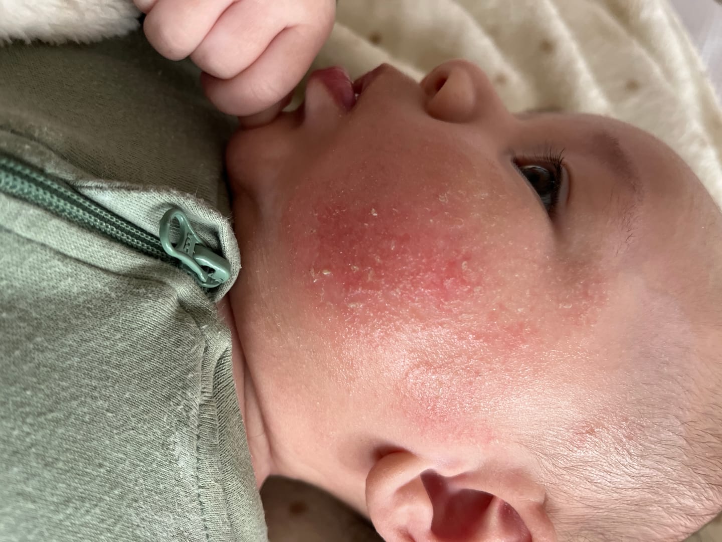 Customer photo review of Kawakawa Repair Balm - Winner, Best SOS/Healing Balm 2024
