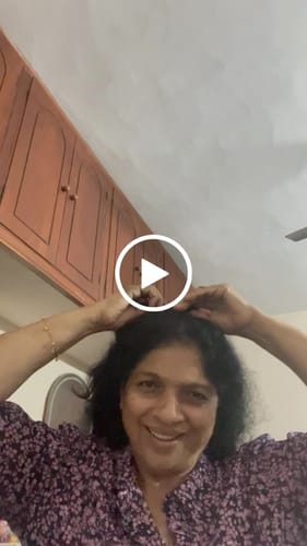 Customer video review of INVISIBLE COVER-UP PATCH - WAVY