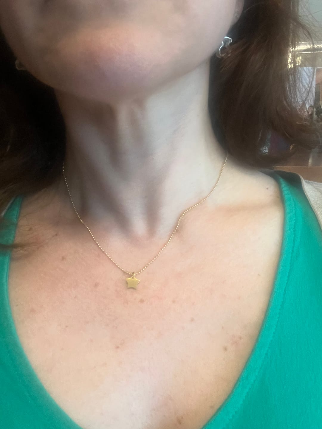 Customer photo review of Collar Five Star