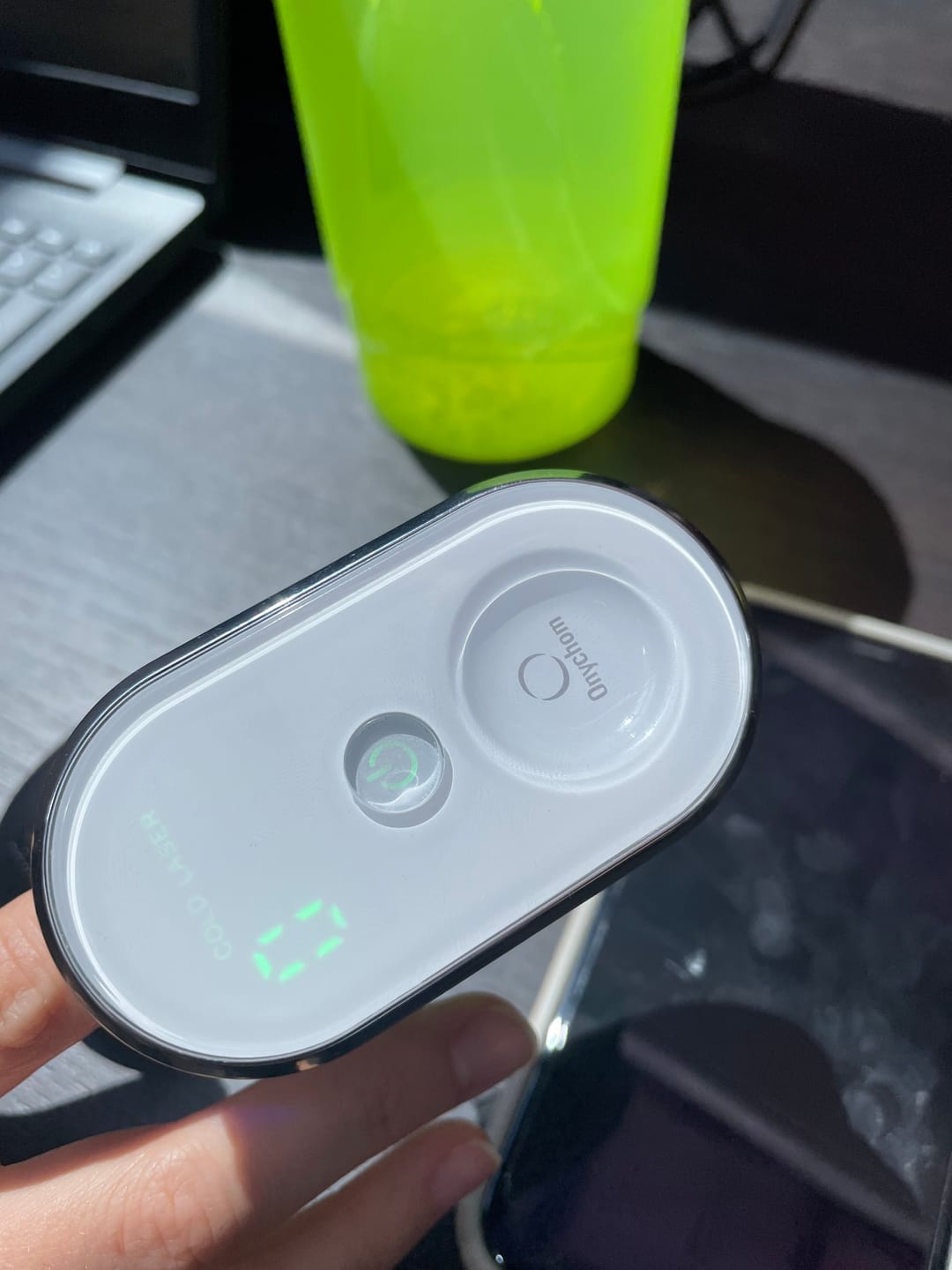 Customer photo review of Onychom Pro Antifungal LED Device