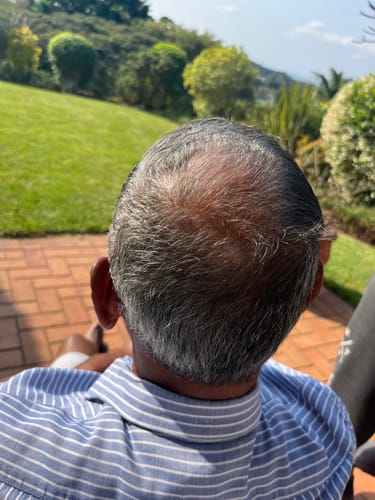 Customer photo review of Glow from Within Collagen Starter Kit