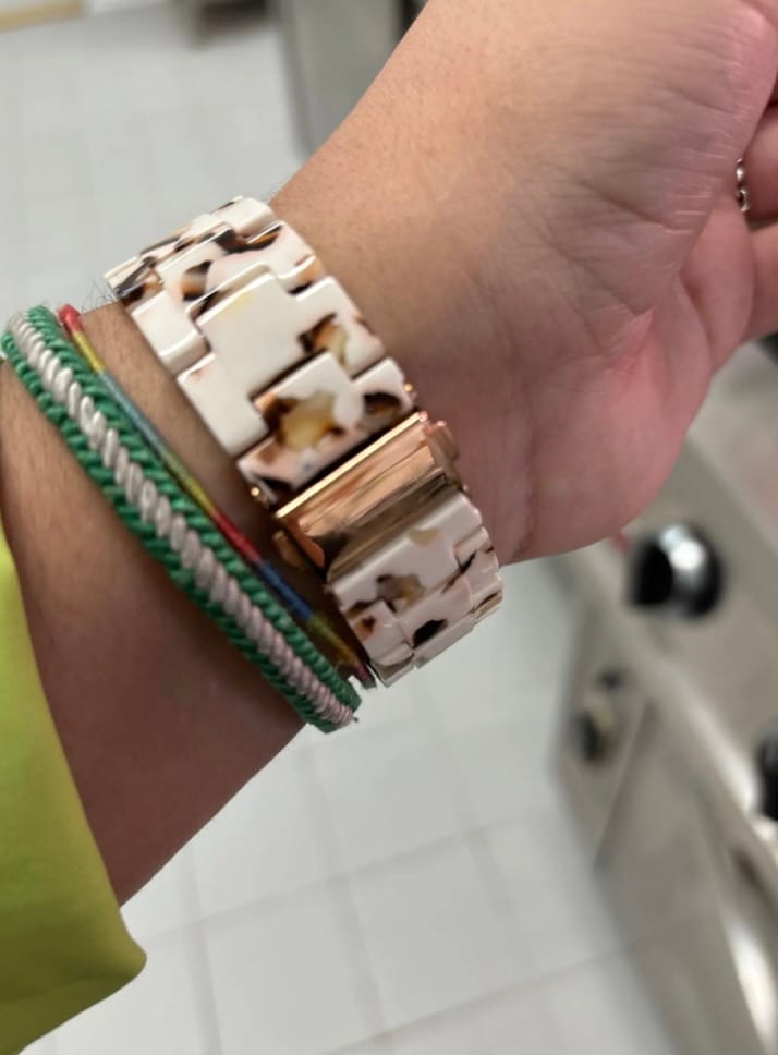 Customer photo review of NEU: Apple Watch Keramikarmband 'Alice'