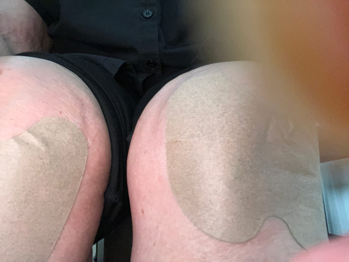 Customer photo review of Auxillium Knee Patch (fka Heaven Patch)