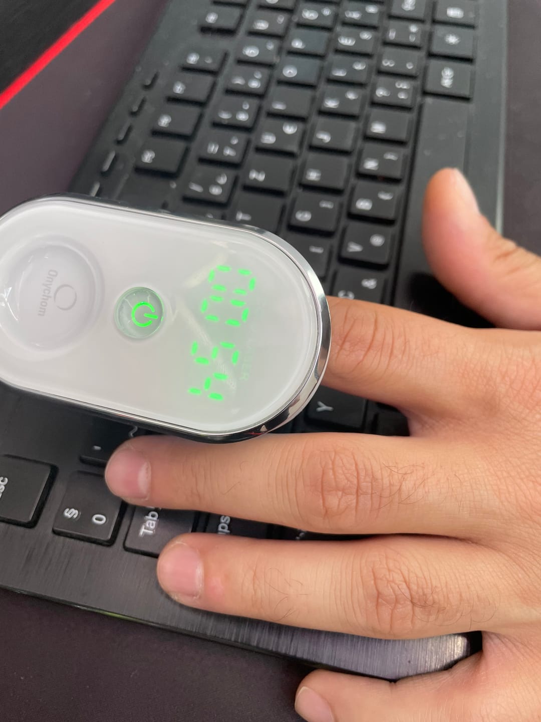 Customer photo review of Onychom Pro Antifungal LED Device