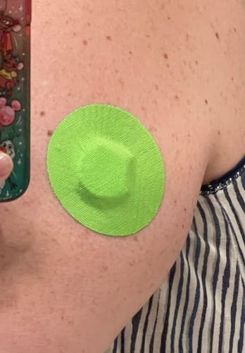 Customer photo review of Skin Grip Original - Freestyle Libre 2/Pump Adhesive Patches - 20 Pack