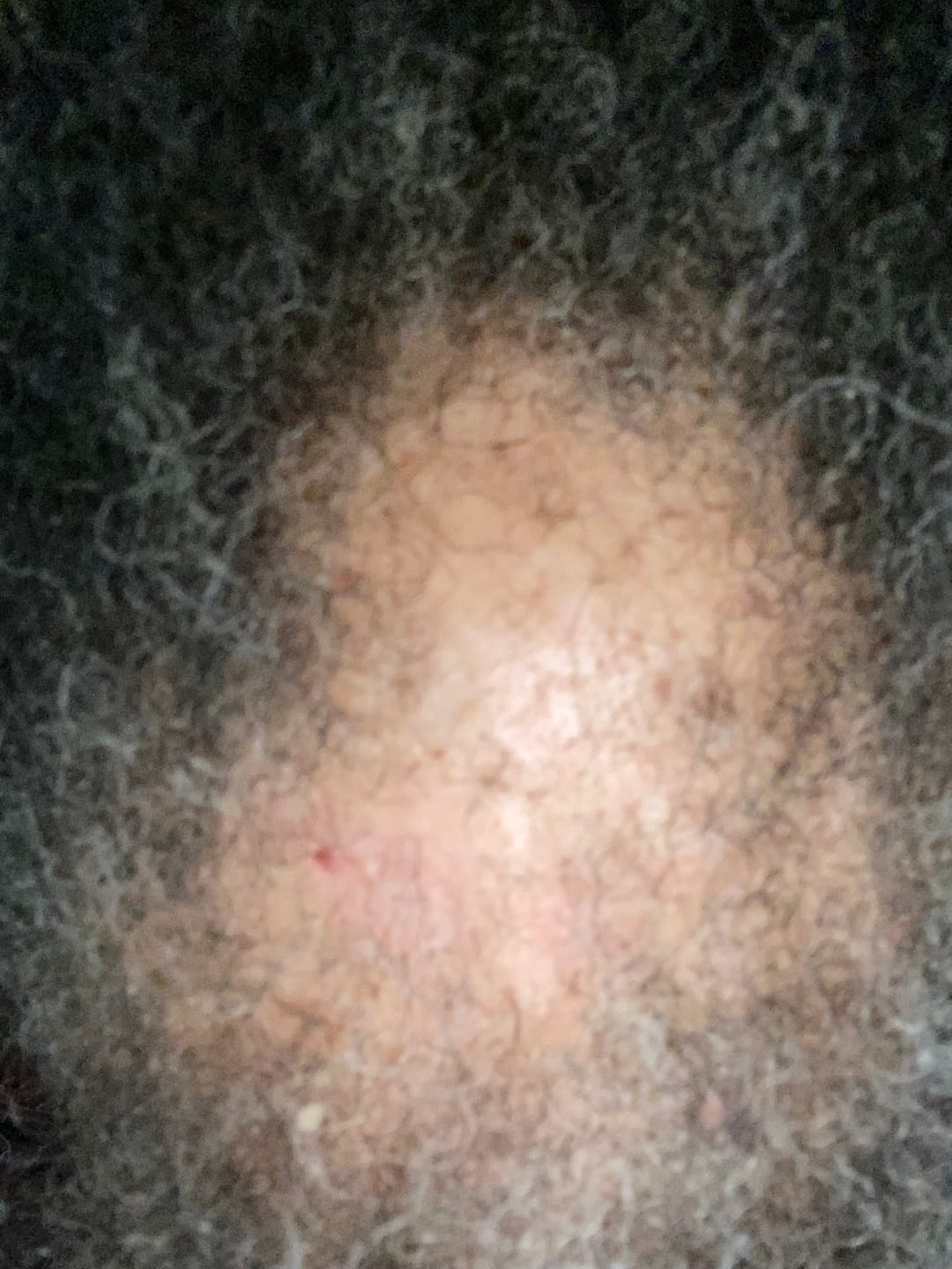Customer photo review of Super Hair Growth Serum