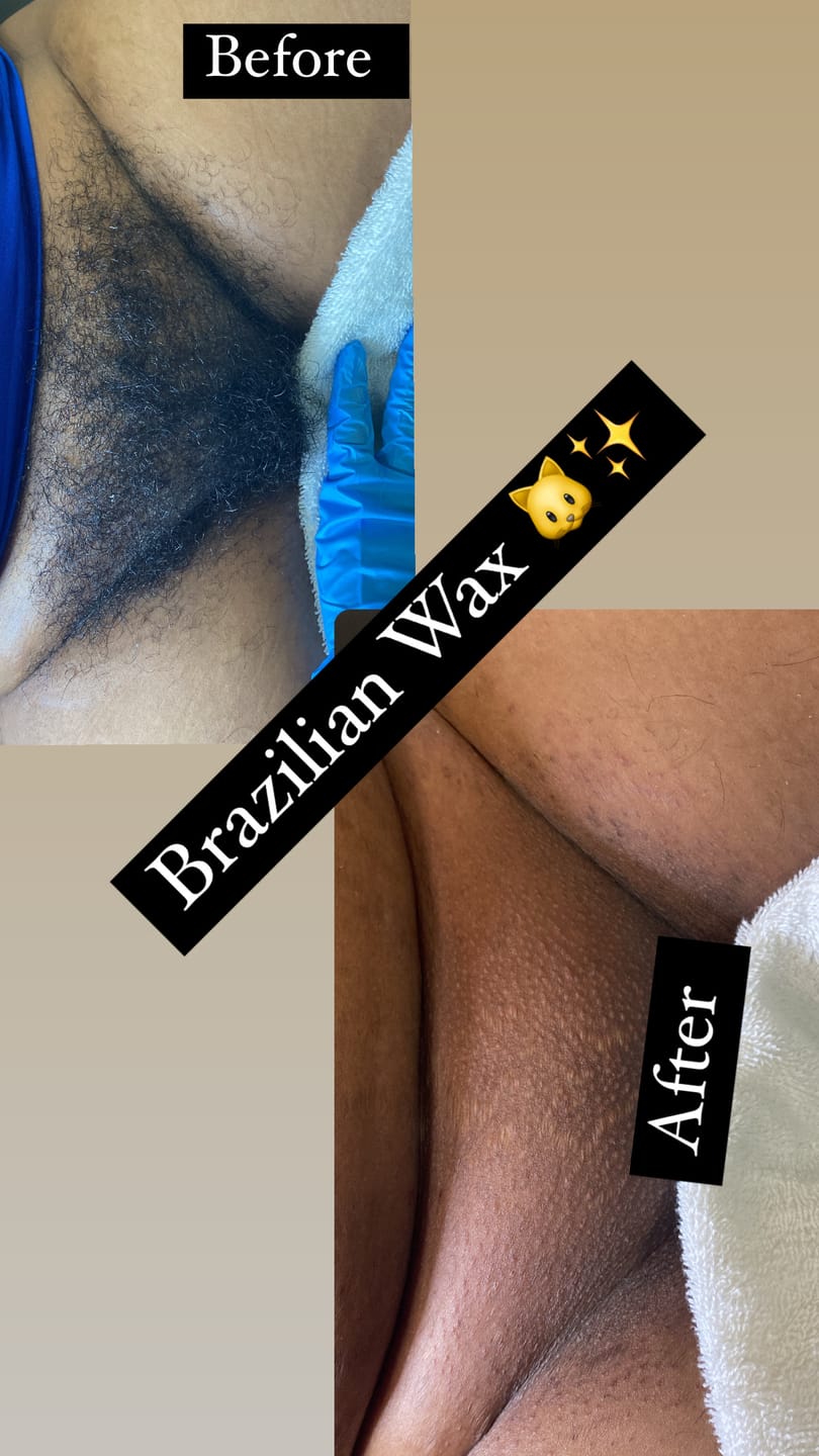 Customer photo review of Pro Series Hair Removal Wax