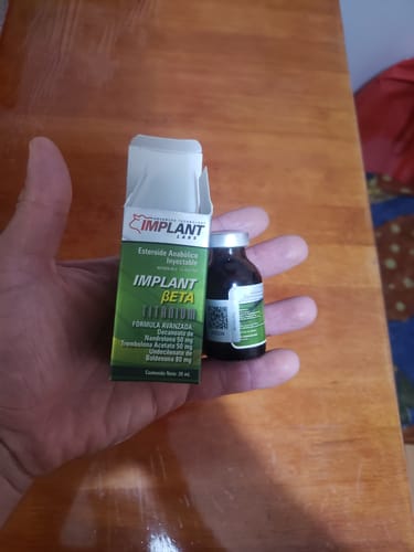 Customer photo review of Implant Beta Titanium