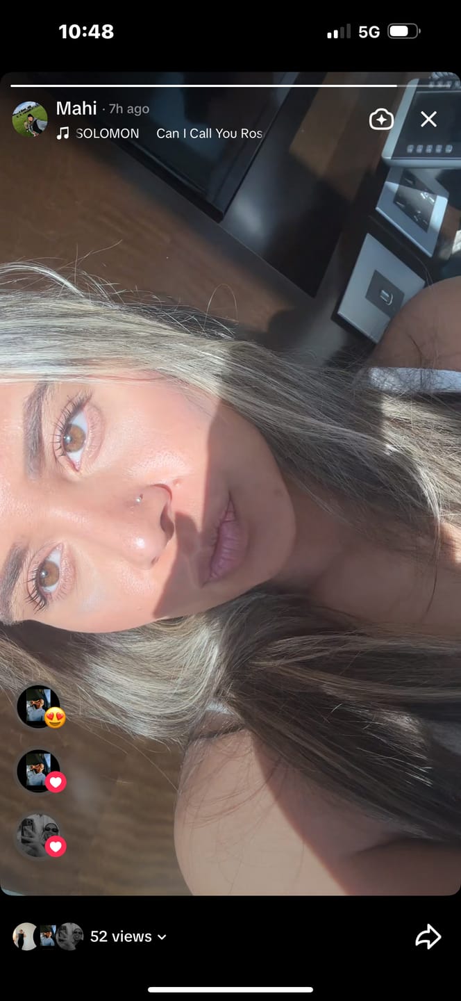 Customer photo review of Eyelash Growth Serum - Original