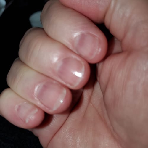 Customer photo review of Rocket Nail Fuel Nail Repair - Purple