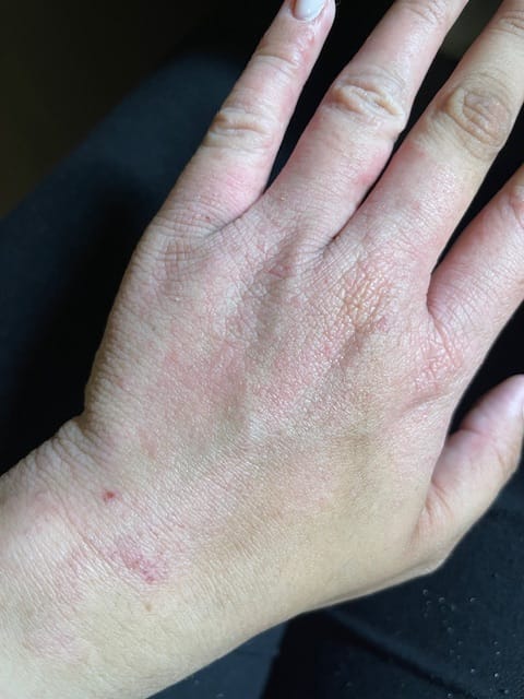 Customer photo review of Everywhere Tallow Balm