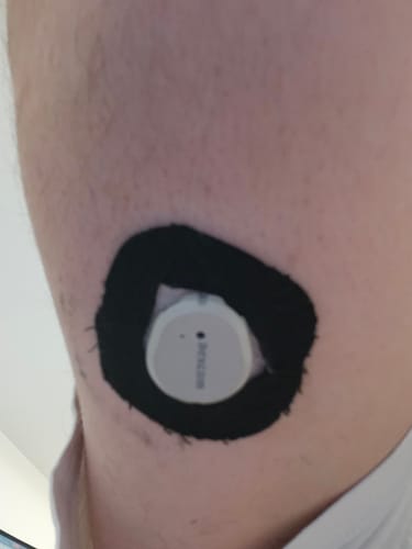 Customer photo review of Skin Grip Original - Dexcom G7 Adhesive Patches (With Cutout) - 20 Pack