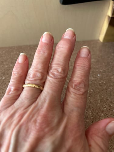Customer photo review of Nail Care Pro -  Nail Strengthener and Repair Serum