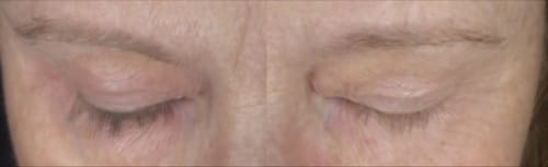 Customer photo review of LASH SERUM
