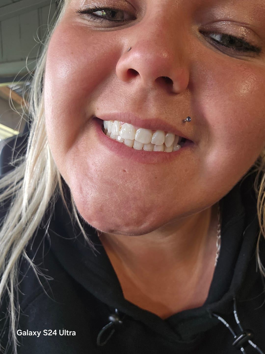 Customer photo review of Pack Bandes Violettes : 2 Paquets de Bandes Violettes Kauka Smile (sans peroxyde)