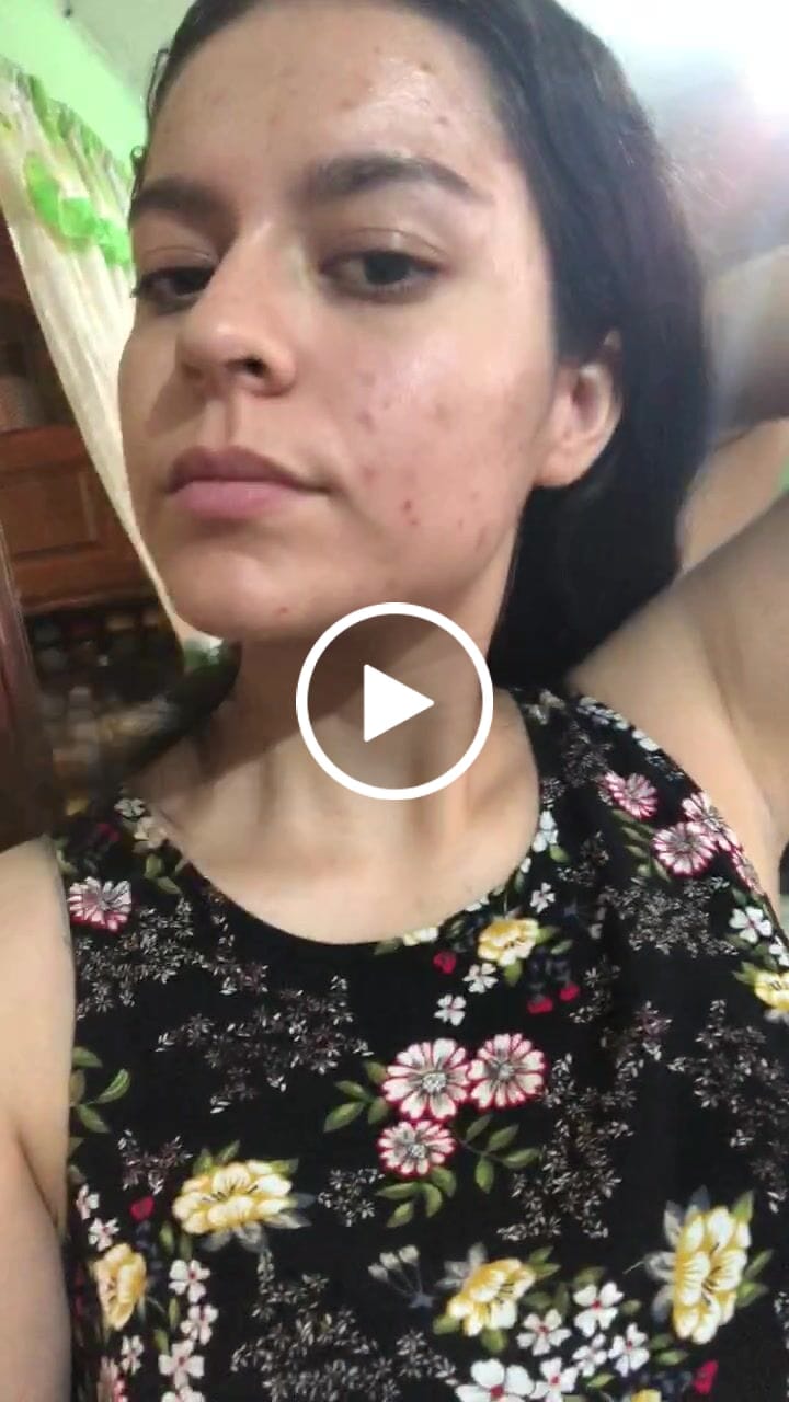 Customer video review of HAIRtamin Fórmula Avanzada