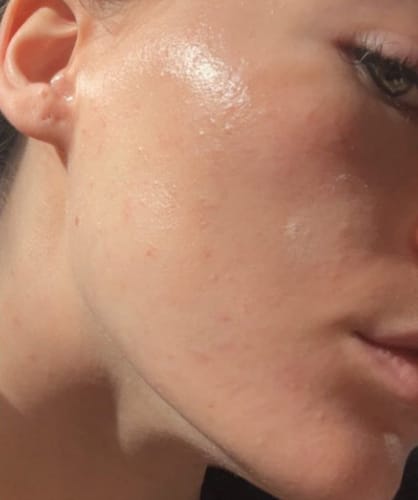 Customer photo review of Tisane Glow up ®