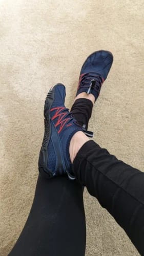 Customer photo review of BareEase