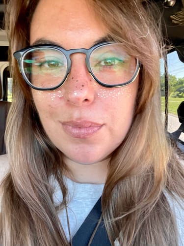 Customer photo review of Gold Stardust Speckles Makeup Patches