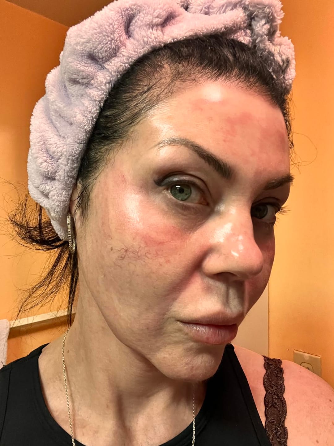 Customer photo review of Dr. Pen HydraPen H3 Newest Hydra Pen From Dr. Pen