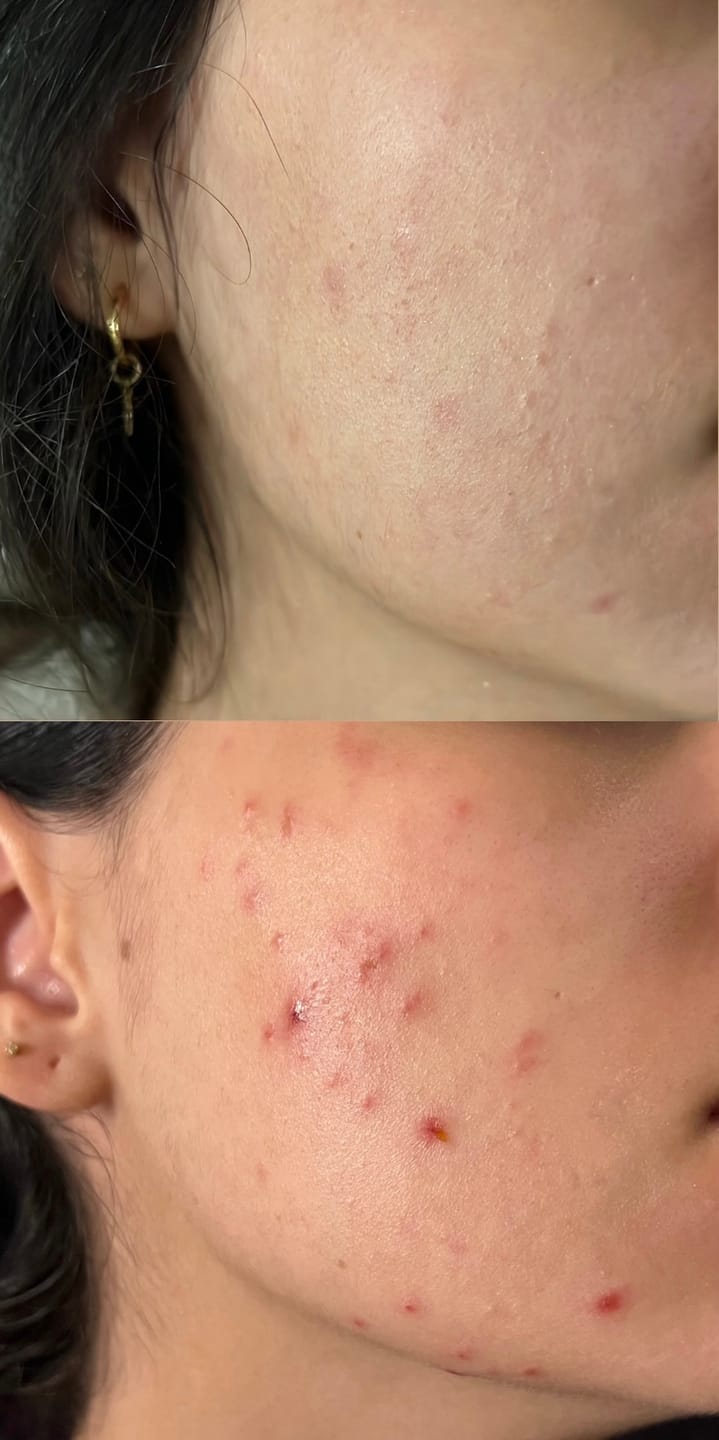 Customer photo review of Óleo de Copaíba ON