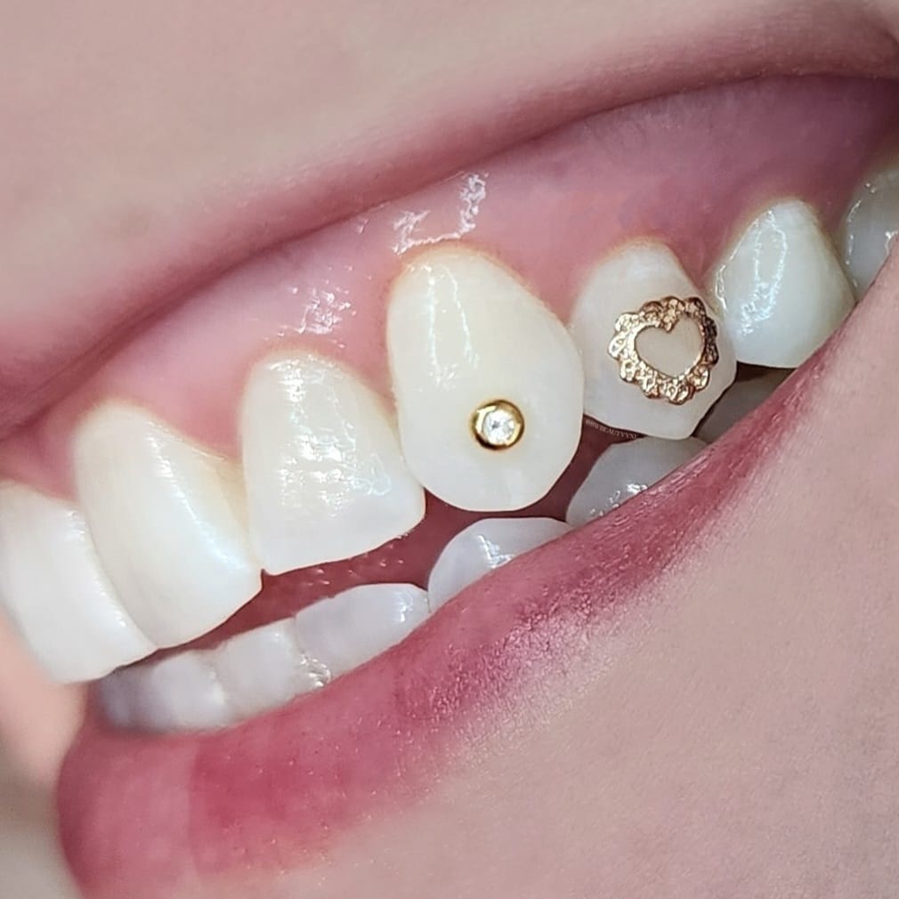 Customer photo review of Round w. Diamond 0.01 ct 22-karat gold