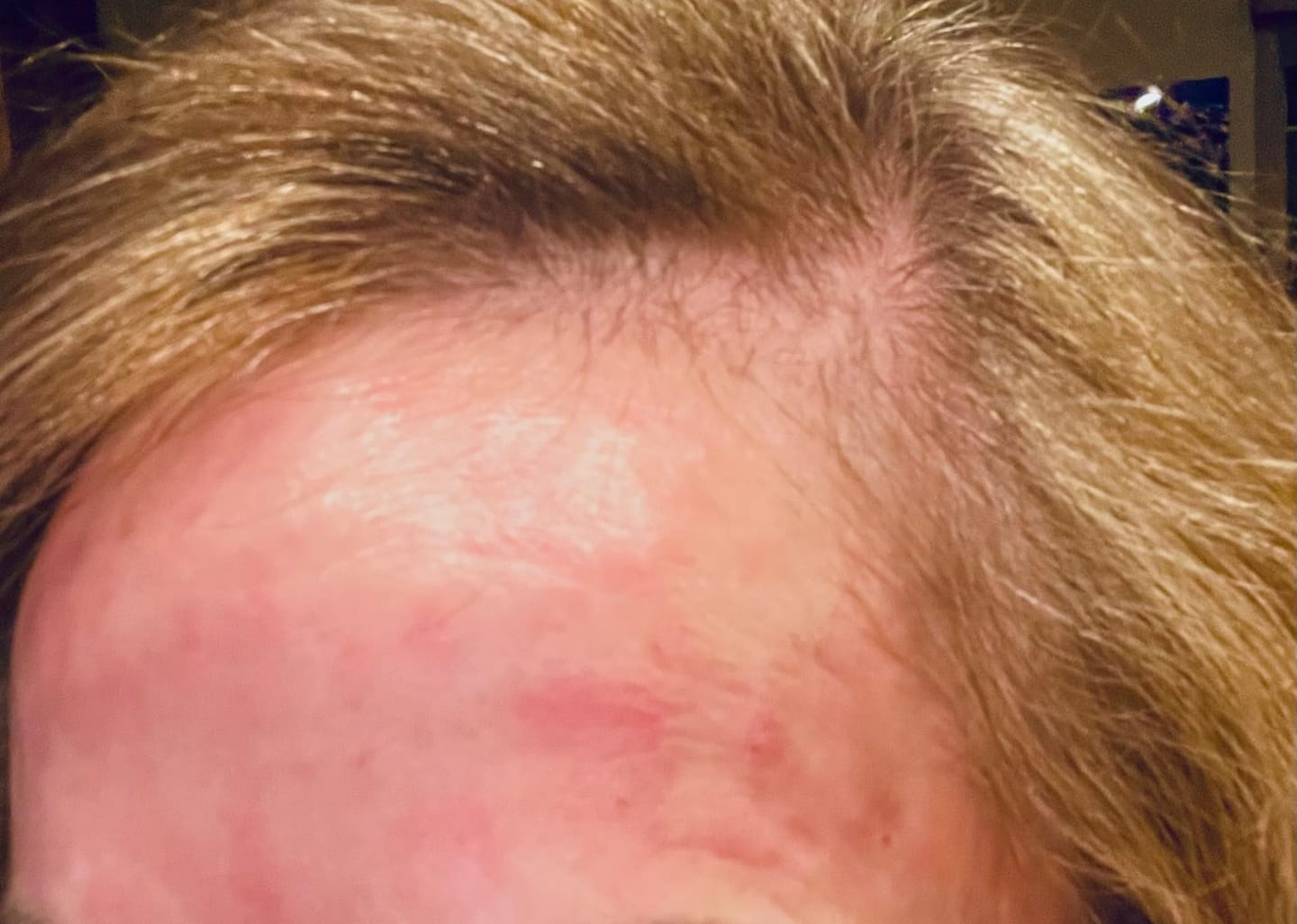 Customer photo review of Dr. Pen A8S Medical Grade