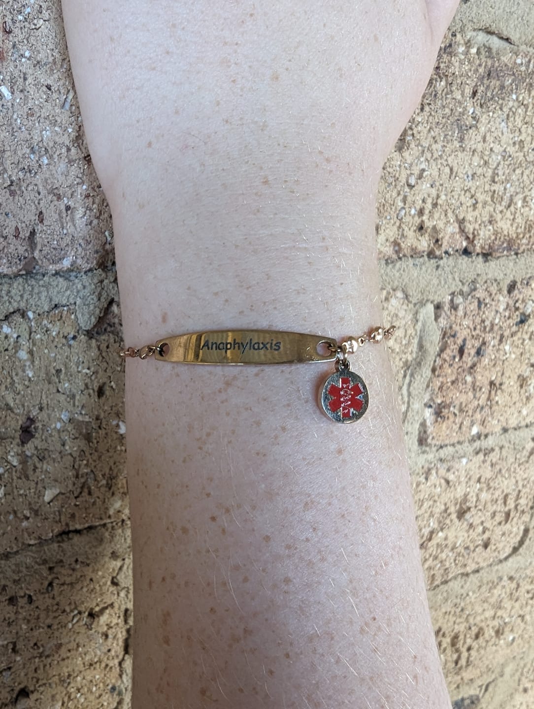 Customer photo review of Personalised Medical Alert Heart Link Bracelet - Rose Gold
